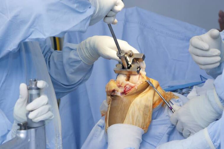 knee joint surgery