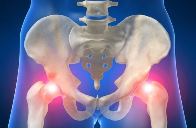 pain in hip joint