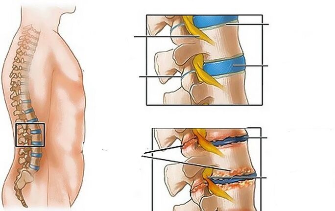 Bone fiber of the lumbar