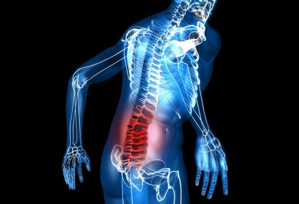 Symptoms of osteoarthritis