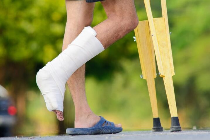 Ankle injuries are a cause of joint disease