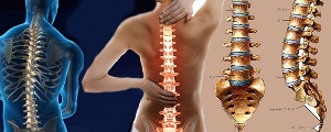 how does cervical bone necrosis develop