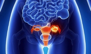 factors that provoke the development of lumbar spine necrosis